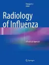 Radiology of Influenza cover