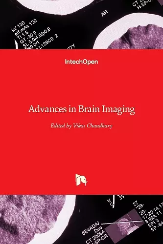 Advances in Brain Imaging cover