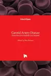 Carotid Artery Disease cover