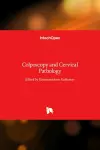 Colposcopy and Cervical Pathology cover