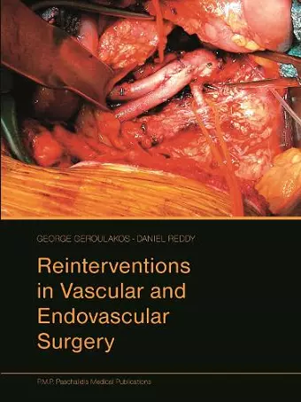 Reinterventions in Vascular and Endovascular Surgery cover