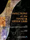 Infections of the Hand & Upper Limb cover