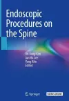 Endoscopic Procedures on the Spine cover