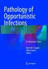 Pathology of Opportunistic Infections cover