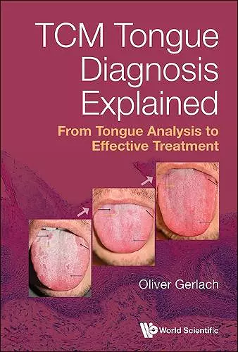 Tcm Tongue Diagnosis Explained: From Tongue Analysis To Effective Treatment cover