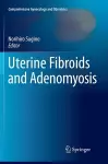 Uterine Fibroids and Adenomyosis cover