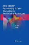 Multi-Modality Neuroimaging Study on Neurobiological Mechanisms of Acupuncture cover