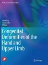 Congenital Deformities of the Hand and Upper Limb cover