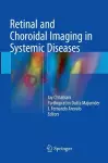 Retinal and Choroidal Imaging in Systemic Diseases cover