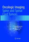 Oncologic Imaging: Spine and Spinal Cord Tumors cover