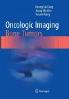 Oncologic Imaging: Bone Tumors cover