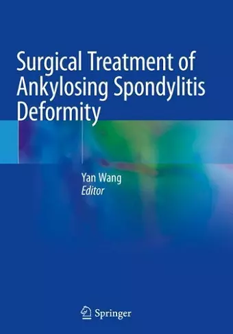 Surgical Treatment of Ankylosing Spondylitis Deformity cover