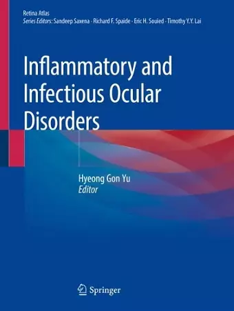 Inflammatory and Infectious Ocular Disorders cover