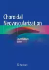 Choroidal Neovascularization cover