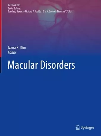 Macular Disorders cover