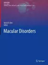 Macular Disorders cover