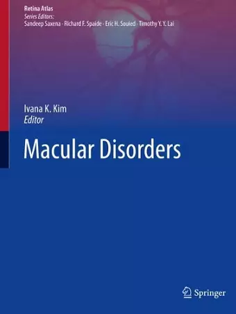 Macular Disorders cover