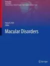 Macular Disorders cover