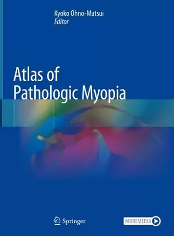 Atlas of Pathologic Myopia cover