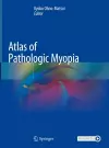 Atlas of Pathologic Myopia cover