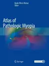 Atlas of Pathologic Myopia cover