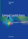 External Carotid Artery cover