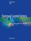 External Carotid Artery cover