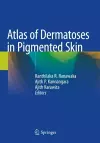 Atlas of Dermatoses in Pigmented Skin cover