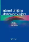 Internal Limiting Membrane Surgery cover