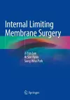 Internal Limiting Membrane Surgery cover