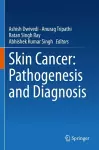 Skin Cancer: Pathogenesis and Diagnosis cover