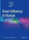 Avian Influenza in Human cover