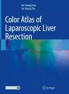 Color Atlas of Laparoscopic Liver Resection cover