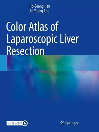 Color Atlas of Laparoscopic Liver Resection cover