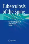 Tuberculosis of the Spine cover