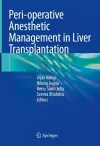 Peri-operative Anesthetic Management in Liver Transplantation cover