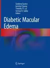 Diabetic Macular Edema cover