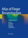 Atlas of Finger Reconstruction cover