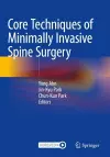 Core Techniques of Minimally Invasive Spine Surgery cover