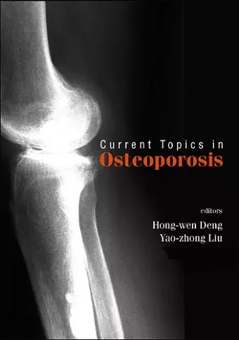 Current Topics In Osteoporosis cover