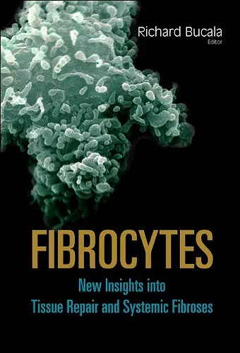 Fibrocytes: New Insights Into Tissue Repair And Systemic Fibroses cover