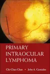 Primary Intraocular Lymphoma cover