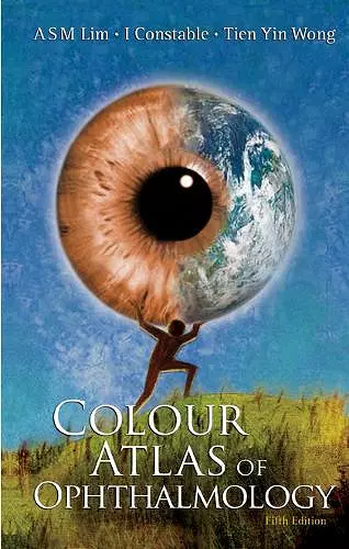 Colour Atlas Of Ophthalmology (Fifth Edition) cover