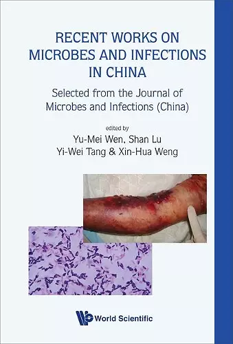 Recent Works On Microbes And Infections In China: Selected From The Journal Of Microbes And Infections (China) cover