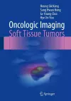 Oncologic Imaging: Soft Tissue Tumors cover