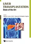 Liver Transplantation: State Of The Art cover