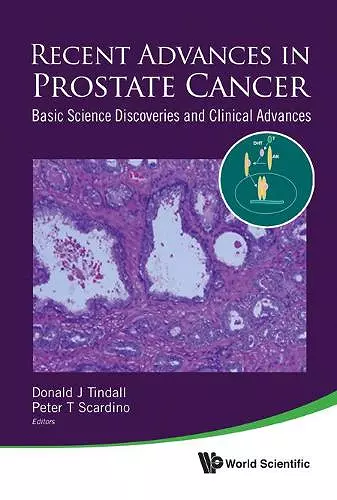 Recent Advances In Prostate Cancer: Basic Science Discoveries And Clinical Advances cover