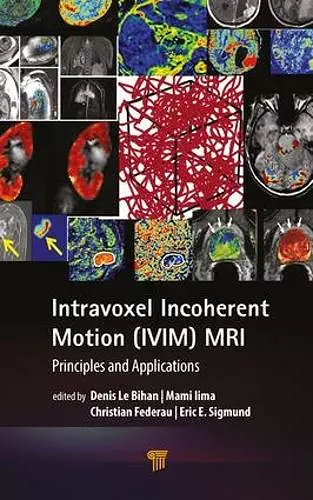 Intravoxel Incoherent Motion (IVIM) MRI cover