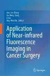 Application of Near-infrared Fluorescence Imaging in Cancer Surgery cover
