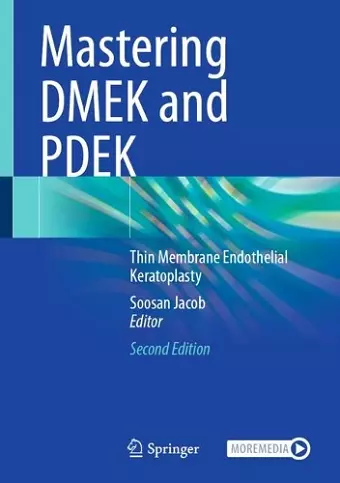 Mastering DMEK and PDEK cover